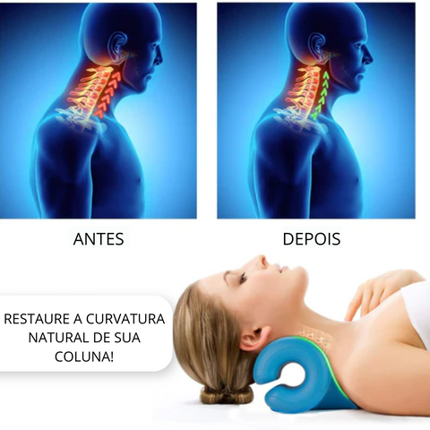 Travesseiro Nuvem Ortopédico: Para Dores No Pescoço Ombro Coluna Cervical